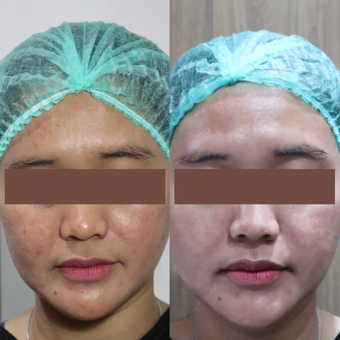 IMAGE REGLOW CLINIC 3